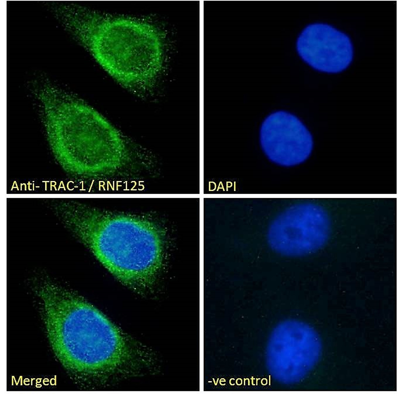 46-303 Immunofluorescence analysis of paraformaldehyde fixed HeLa cells, permeabilized with 0.15% Triton. Primary incubation 1hr (10ug/ml) followed by Alexa Fluor 488 secondary antibody (2ug/ml) , showing endoplasmic reticulum/Golgi and some nuclear stain