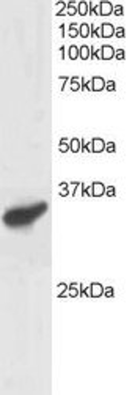 46-309 staining (1ug/ml) of Human Heart lysate (RIPA buffer, 30ug total protein per lane) . Primary incubated for 1 hour. Detected by western blot using chemiluminescence.