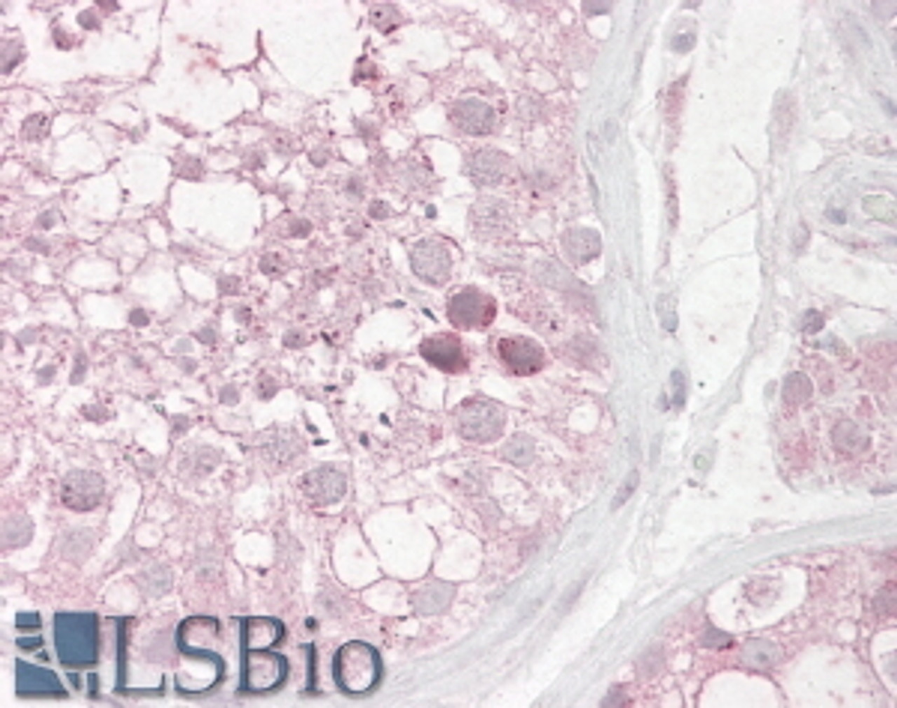 46-311 (3.8ug/ml) staining of paraffin embedded Human Testis. Steamed antigen retrieval with citrate buffer pH 6, AP-staining.