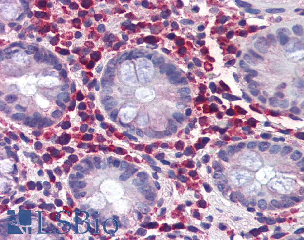 46-314 (5ug/ml) staining of paraffin embedded Human Colon. Steamed antigen retrieval with citrate buffer pH 6, AP-staining. <strong>This data is from a previous batch, not on sale.</strong>