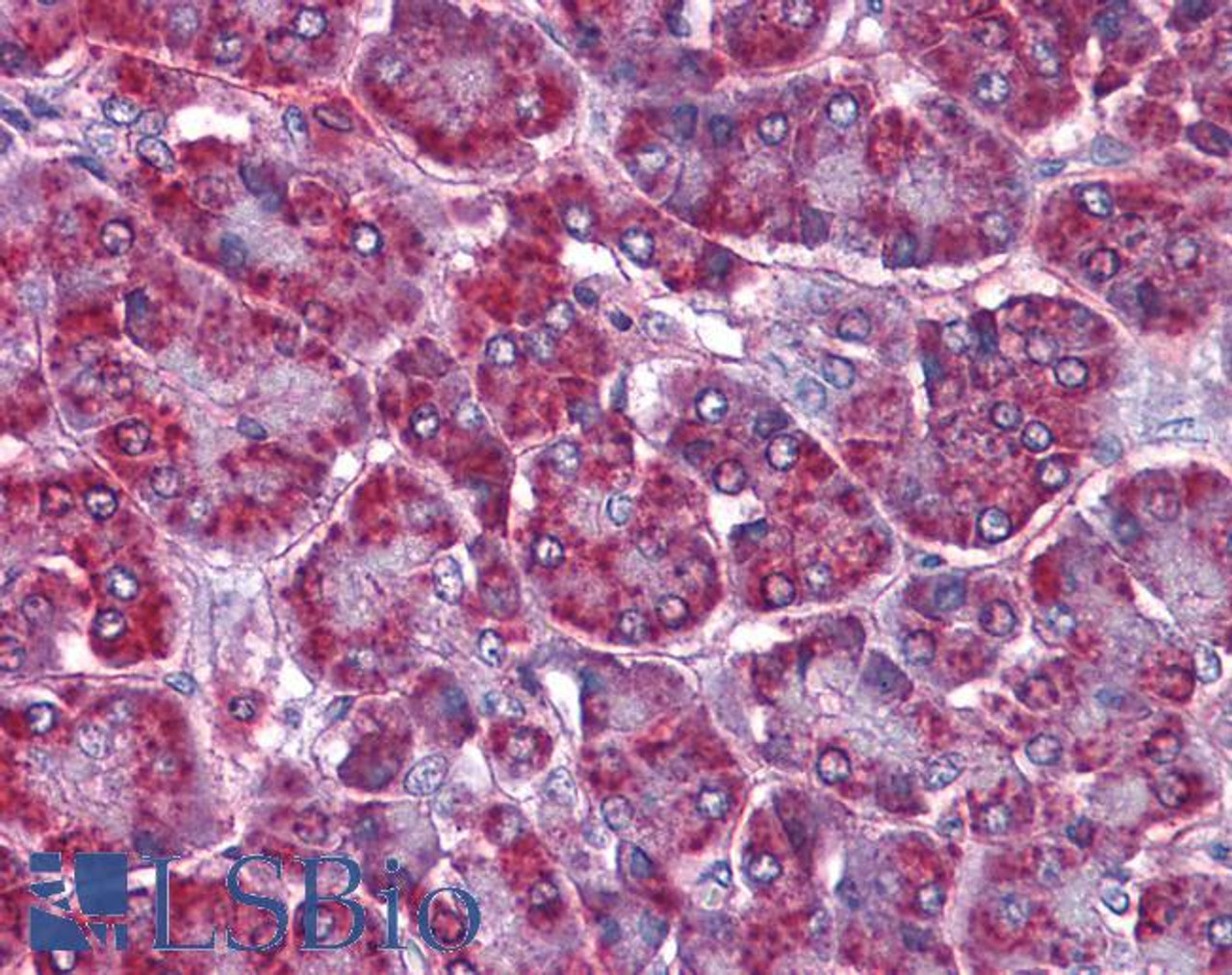 46-318 (0.5ug/ml) staining of Human Brain (Cerebellum) lysate (35ug protein in RIPA buffer) . Primary incubation was 1 hour. Detected by chemiluminescence.