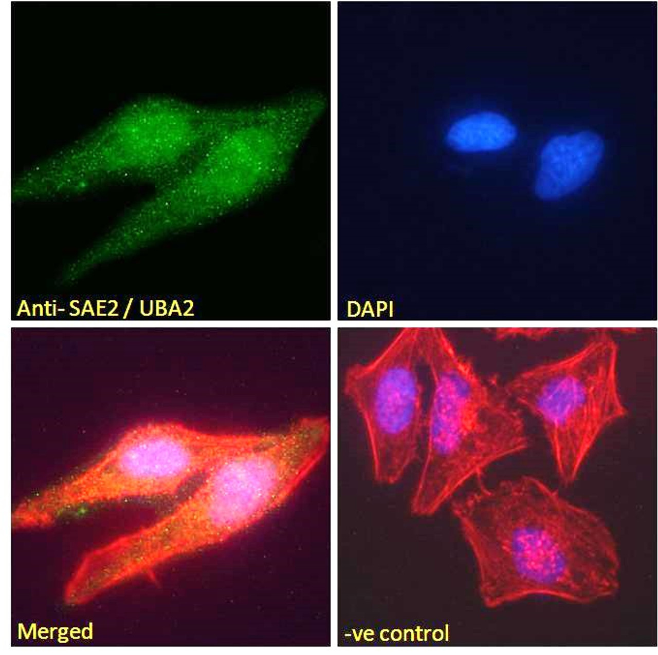 46-329 Immunofluorescence analysis of paraformaldehyde fixed HeLa cells, permeabilized with 0.15% Triton. Primary incubation 1hr (10ug/ml) followed by Alexa Fluor 488 secondary antibody (2ug/ml) , showing nuclear and weak cytoplasmic weak staining. Actin