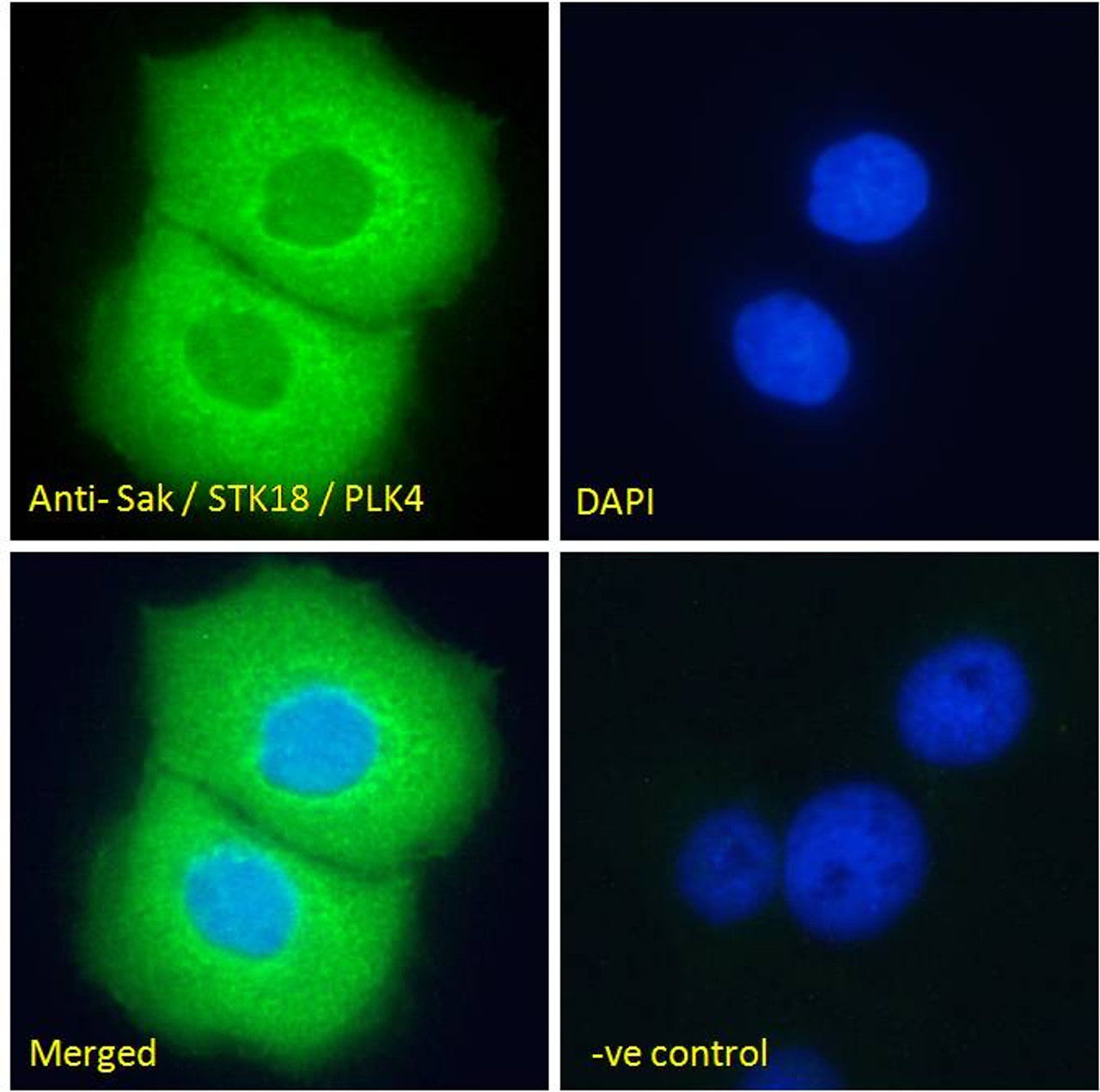 46-331 Immunofluorescence analysis of paraformaldehyde fixed A431 cells, permeabilized with 0.15% Triton. Primary incubation 1hr (10ug/ml) followed by Alexa Fluor 488 secondary antibody (2ug/ml) , showing cytoplasmic staining. The nuclear stain is DAPI (b
