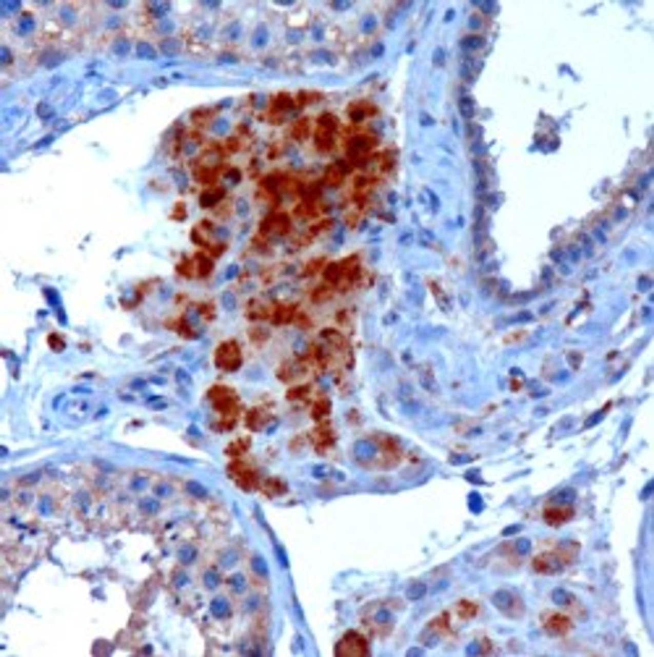 46-339 staining of HFF cell lysate with B) 100nM siRNA or A) control siRNA. Detected by chemiluminescence. Data kindly provided by Laura Papp and Kum Kum Khanna, Brisbane, Australia.