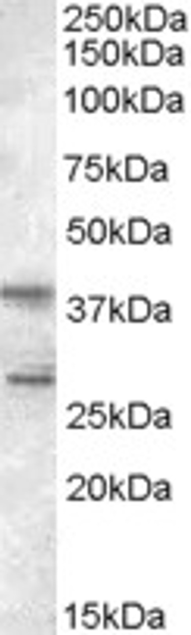 46-341 (0.5ug/ml) staining of Jurkat lysate (35ug protein in RIPA buffer) . Primary incubation was 1 hour. Detected by chemiluminescence.