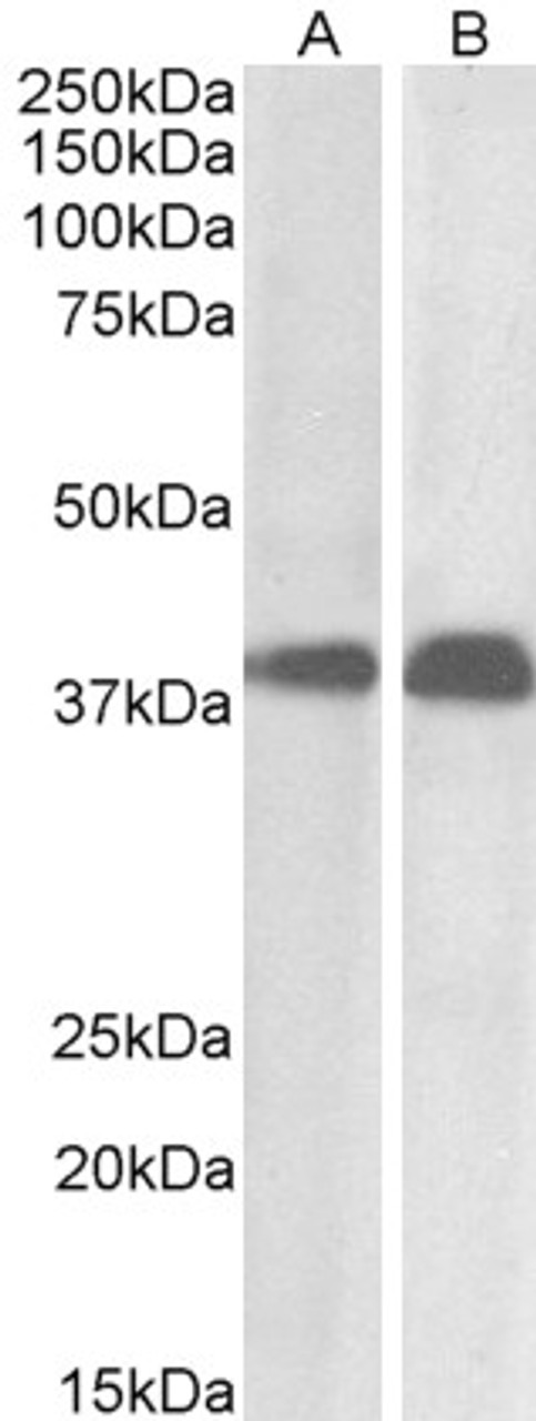 46-360 (0.01ug/ml) staining of Daudi (A) and Molt4 (B) cell lysate (35ug protein in RIPA buffer) . Primary incubation was 1 hour. Detected by chemiluminescence.