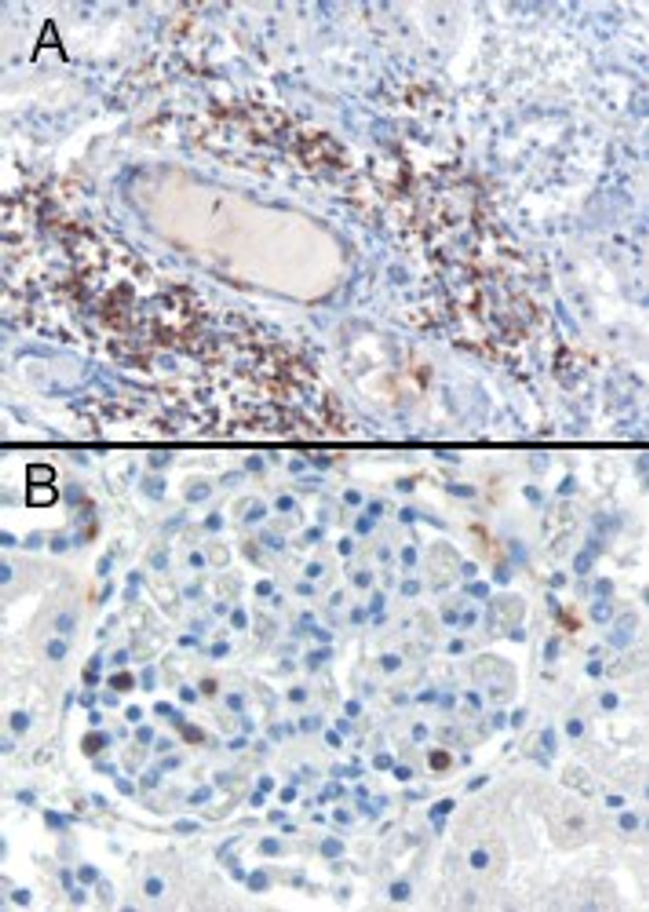 46-367 (0.3ug/ml) staining of paraffin embedded Human Kidnay. Cytoplasmic staining of lymphocytes A) in the interstitial parenchyma of the kidney. B) in a glomerulus of the kidney. Microwaved antigen retrieval with citrate buffer pH 6, HRP-staining.