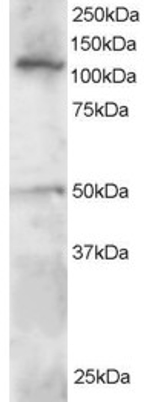 46-385 staining (0.5ug/ml) of Jurkat lysate (RIPA buffer, 30ug total protein per lane) . Primary incubated for 1 hour. Detected by western blot using chemiluminescence.