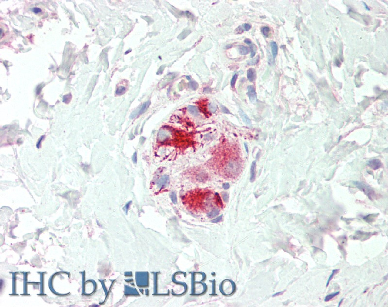 HEK293 overexpressing SMEK1 and probed with 46-386 (mock transfection in first lane) .