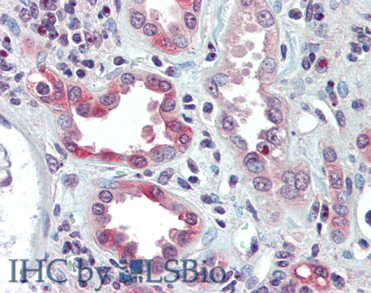 46-392 (0.1ug/ml) staining of Rat Kidney lysate (35ug protein in RIPA buffer) . Detected by chemiluminescence.