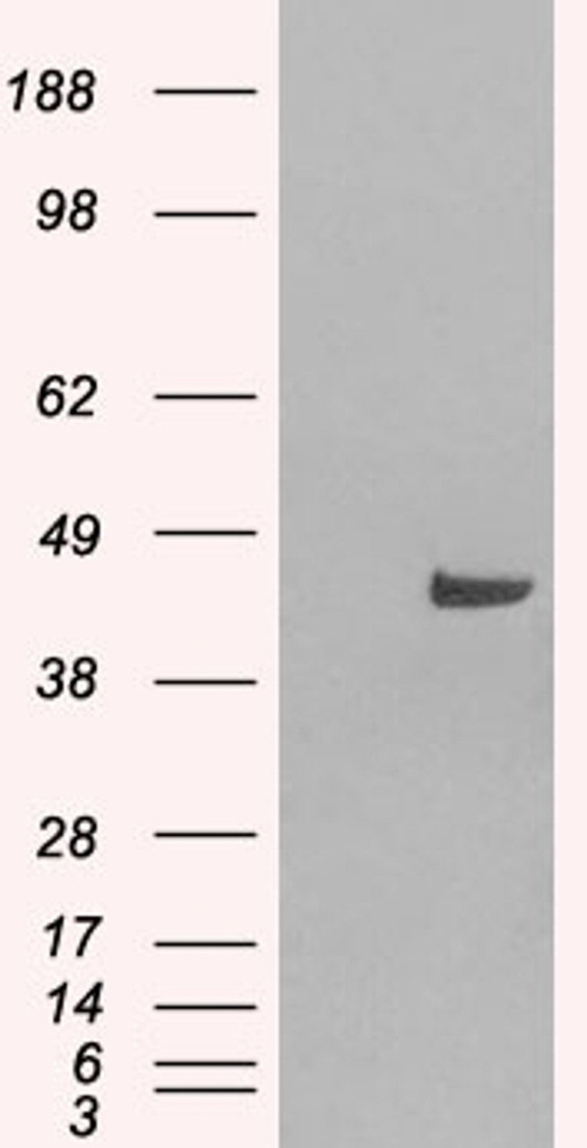 HEK293 overexpressing SNX16 and probed with 46-399 (mock transfection in first lane) .