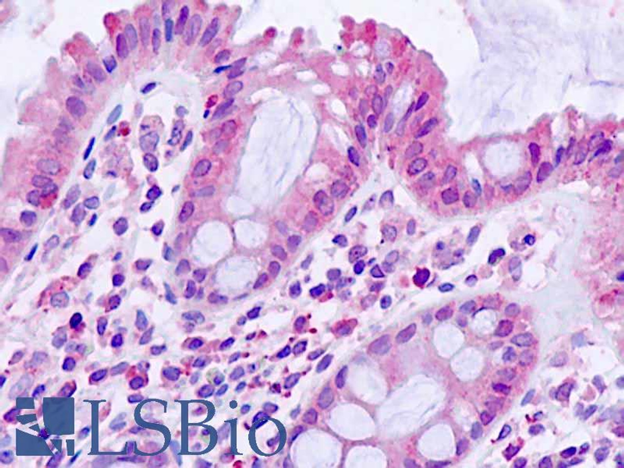 MDCK overexpressing Mouse Btbd7 (third lane) and probed with 42-345 (mock transfection in first lane, full construct chemically suppressed in second lane) .