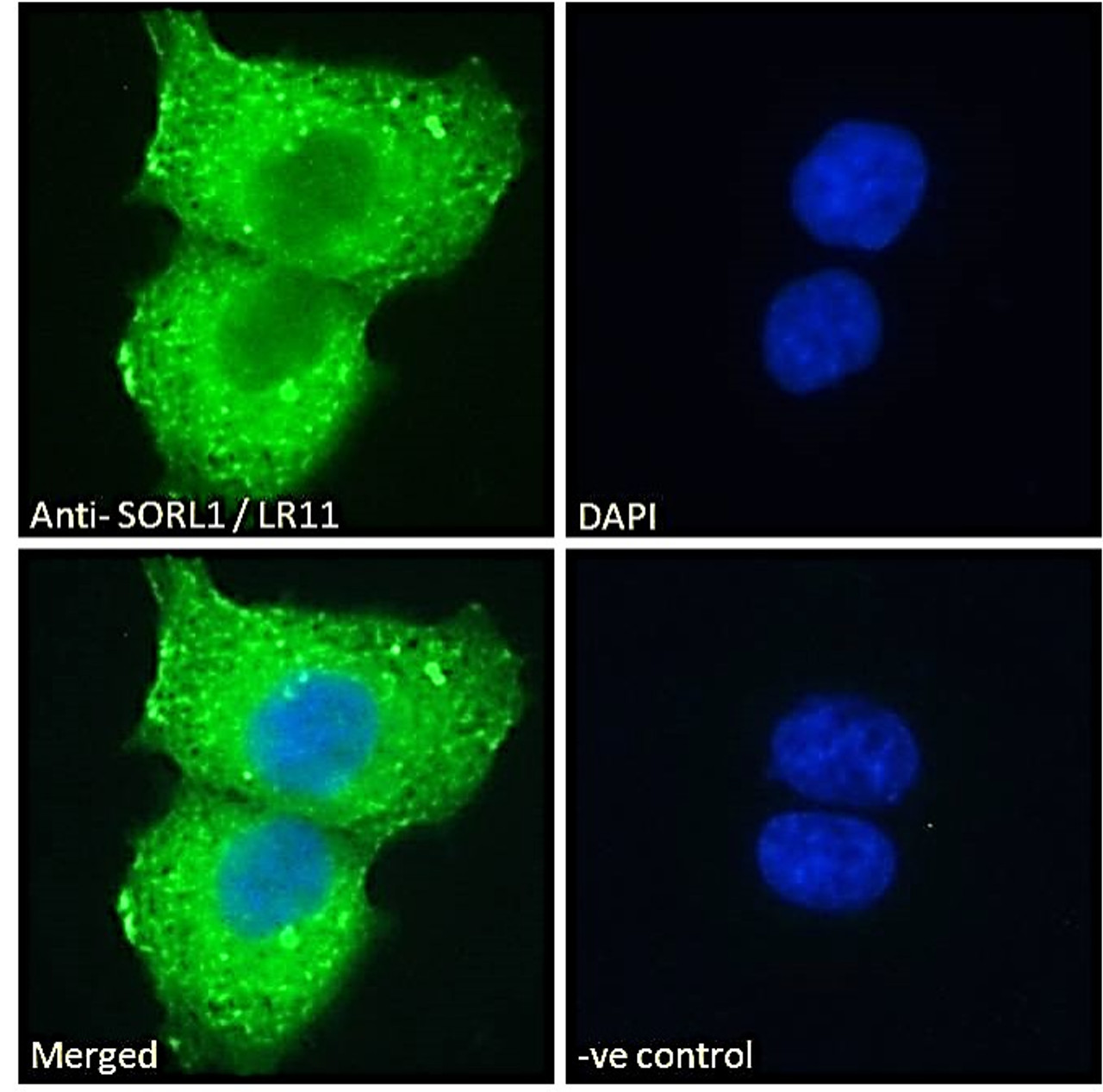 46-418 Immunofluorescence analysis of paraformaldehyde fixed A431 cells, permeabilized with 0.15% Triton. Primary incubation 1hr (10ug/ml) followed by Alexa Fluor 488 secondary antibody (2ug/ml) , showing cytoplasmic with endosome staining. The nuclear st