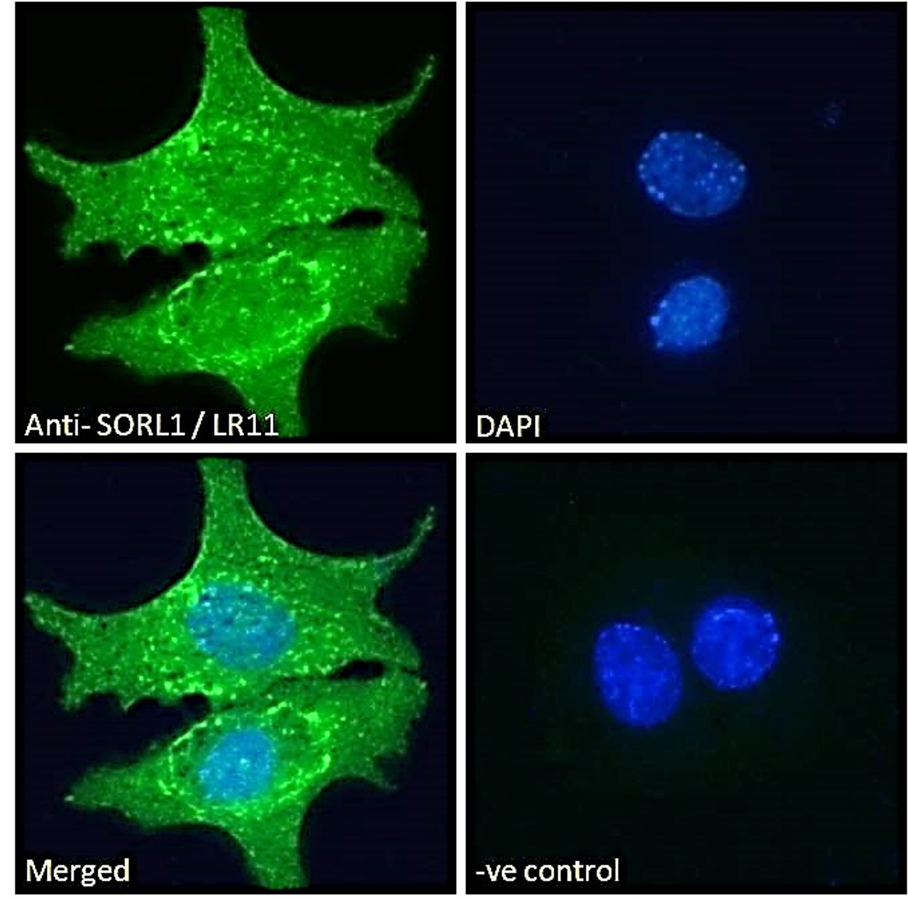 46-418 Immunofluorescence analysis of paraformaldehyde fixed HepG2 cells, permeabilized with 0.15% Triton. Primary incubation 1hr (10ug/ml) followed by Alexa Fluor 488 secondary antibody (2ug/ml) , showing cytoplasmic/endosome, membrane and nuclear staini
