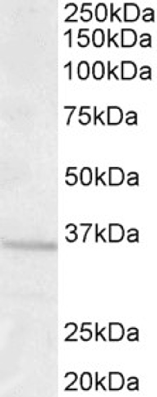 HEK293 overexpressing Human STX6 and probed with 46-449 (mock transfection in first lane) .