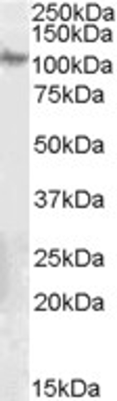 46-455 (1ug/ml) staining of Human Muscle lysate (35ug protein in RIPA buffer) . Detected by chemiluminescence.