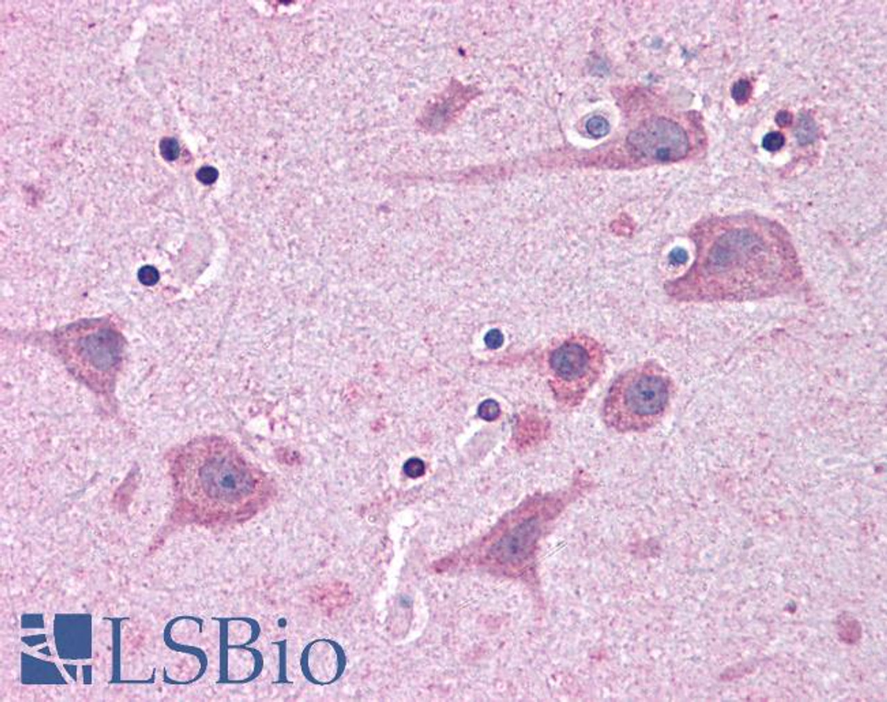 46-464 (5ug/ml) staining of paraffin embedded Human Cortex. Steamed antigen retrieval with citrate buffer pH 6, AP-staining.