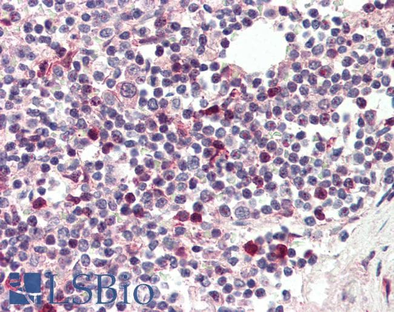 46-474 Negative Control showing staining of paraffin embedded Mouse Thymus, with no primary antibody.