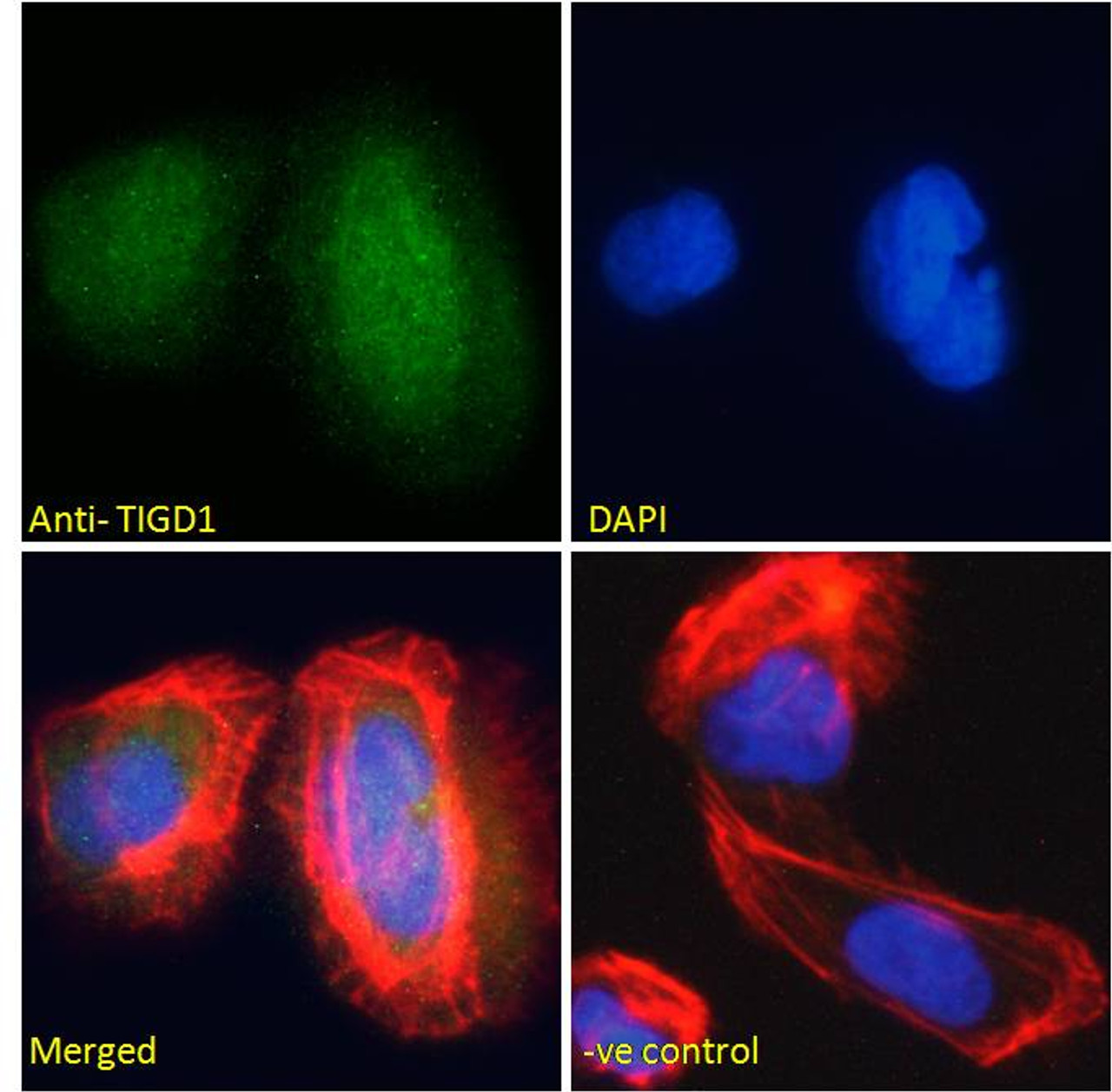 46-494 Immunofluorescence analysis of paraformaldehyde fixed U2OS cells, permeabilized with 0.15% Triton. Primary incubation 1hr (10ug/ml) followed by Alexa Fluor 488 secondary antibody (2ug/ml) , showing nuclear staining. Actin filaments were stained wit