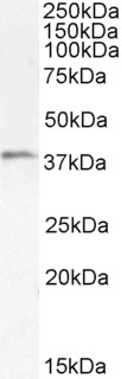 46-495 (2ug/ml) staining of Jurkat (A) , MOLT4 (B) and negative control A431 (C) cell lysate (35ug protein in RIPA buffer) . Detected by chemiluminescence.