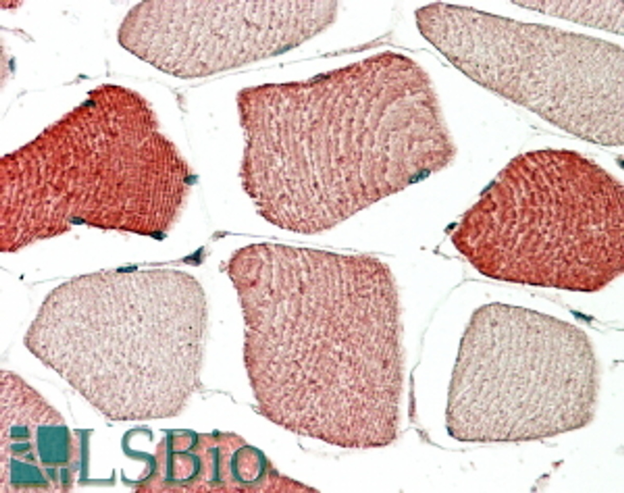 46-505 (5ug/ml) staining of paraffin embedded Human Skeletal Muscle. Steamed antigen retrieval with citrate buffer pH 6, AP-staining.