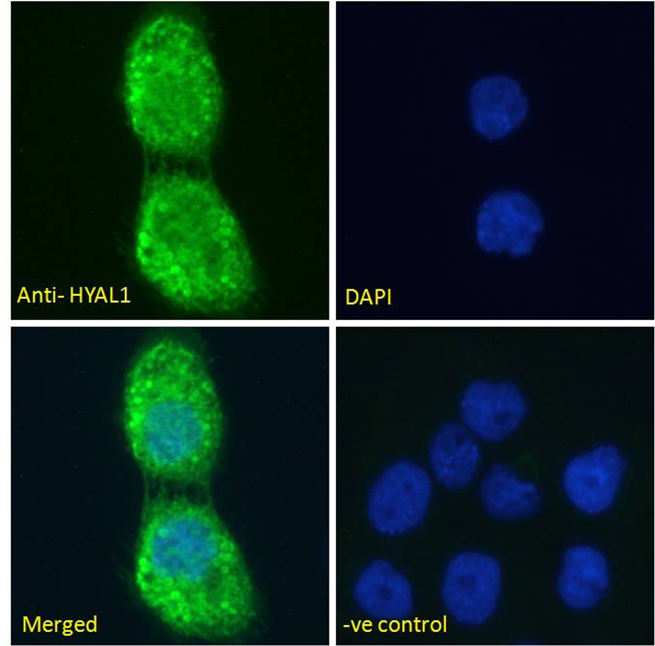 46-506 (1ug/ml) staining of Human Lymph Node lysate (35ug protein in RIPA buffer) . Detected by chemiluminescence.