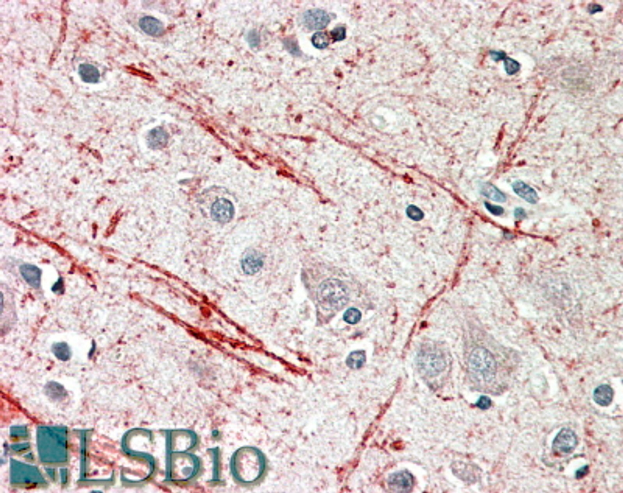 42-859 (0.5ug/ml) staining of Mouse Brain lysate (35ug protein in RIPA buffer) . Detected by chemiluminescence.