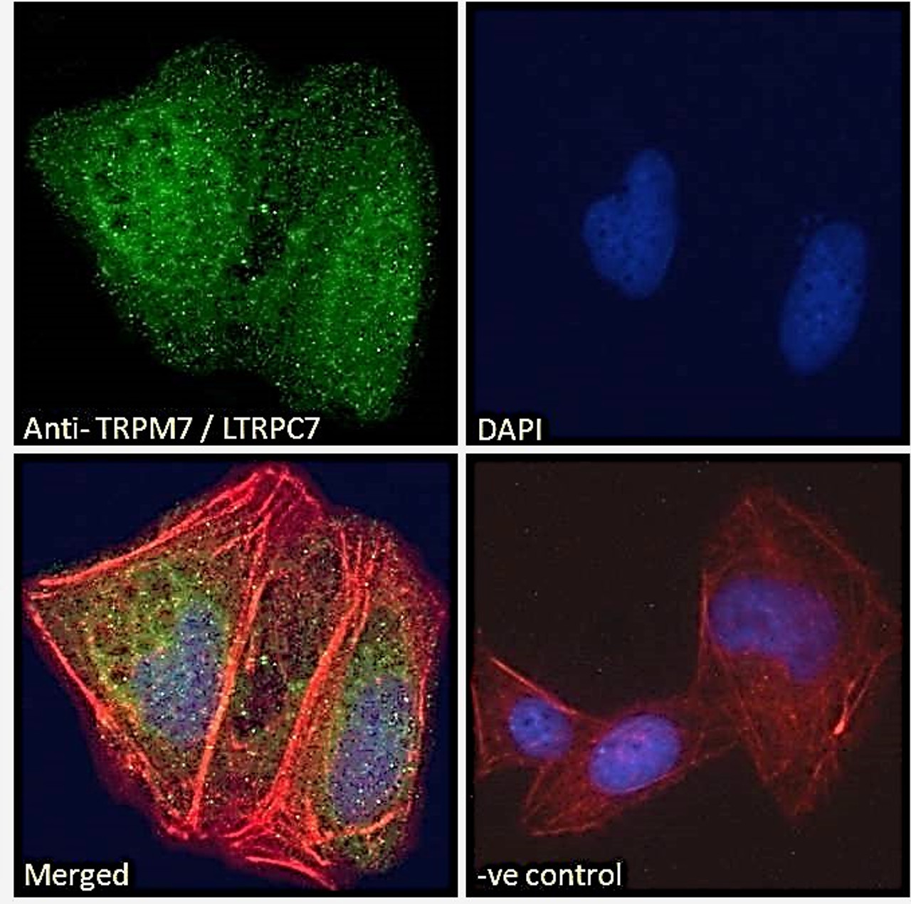 46-531 Immunofluorescence analysis of paraformaldehyde fixed U2OS cells, permeabilized with 0.15% Triton. Primary incubation 1hr (10ug/ml) followed by Alexa Fluor 488 secondary antibody (2ug/ml) , showing nuclear and cytoplasmic staining. Actin filaments