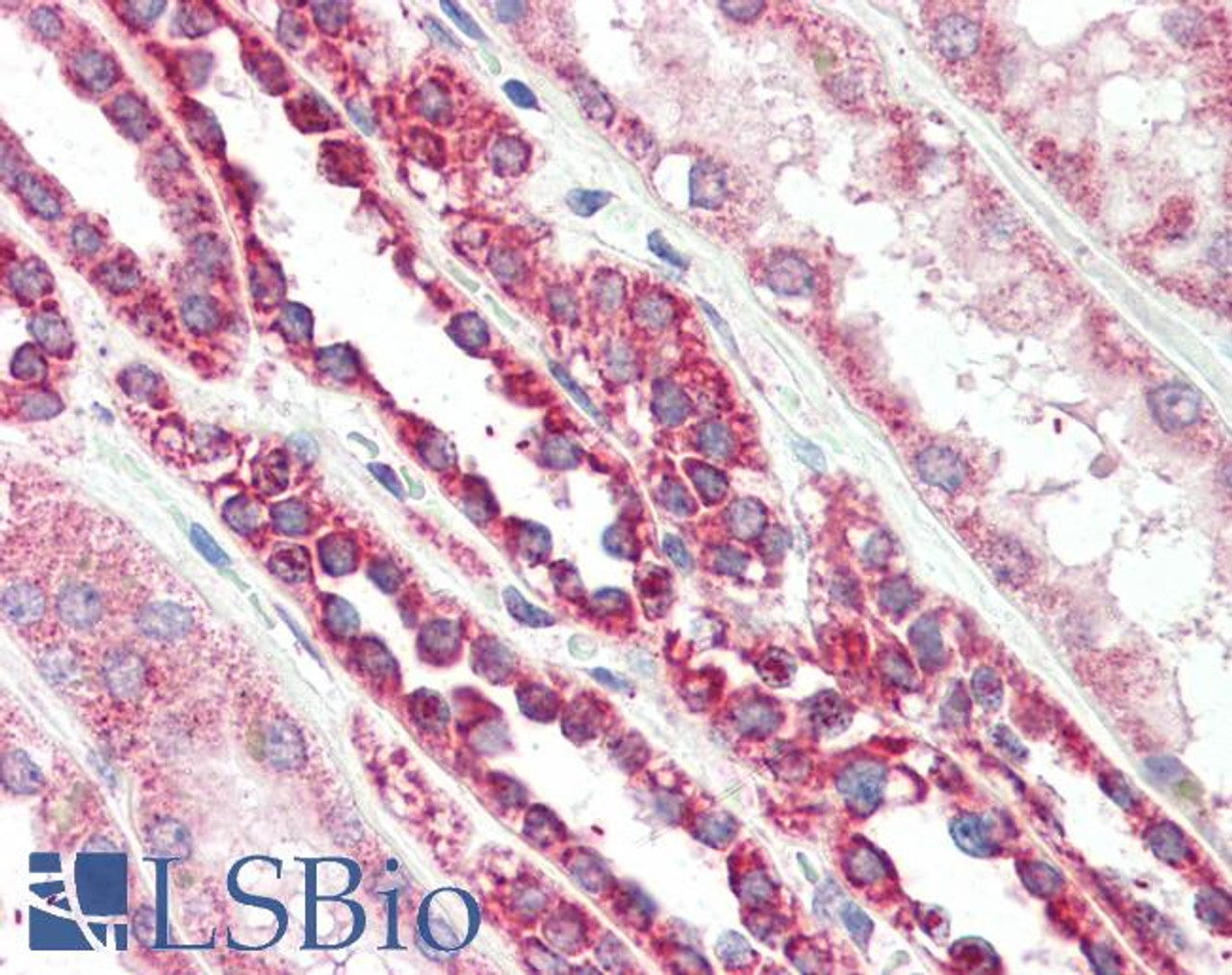 46-538 (2.5ug/ml) staining of paraffin embedded Human Colon. Steamed antigen retrieval with citrate buffer pH 6, AP-staining.
