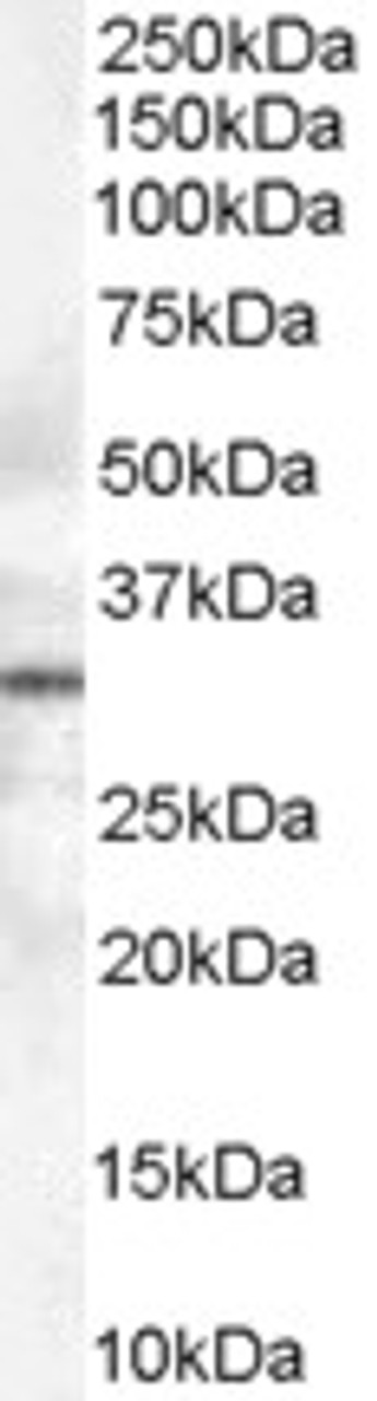 46-548 (1ug/ml) staining of Rat Adipose (A) and (0.5ug/ml) Skeletal Muscle (B) lysate (35ug protein in RIPA buffer) Detected by chemiluminescence.