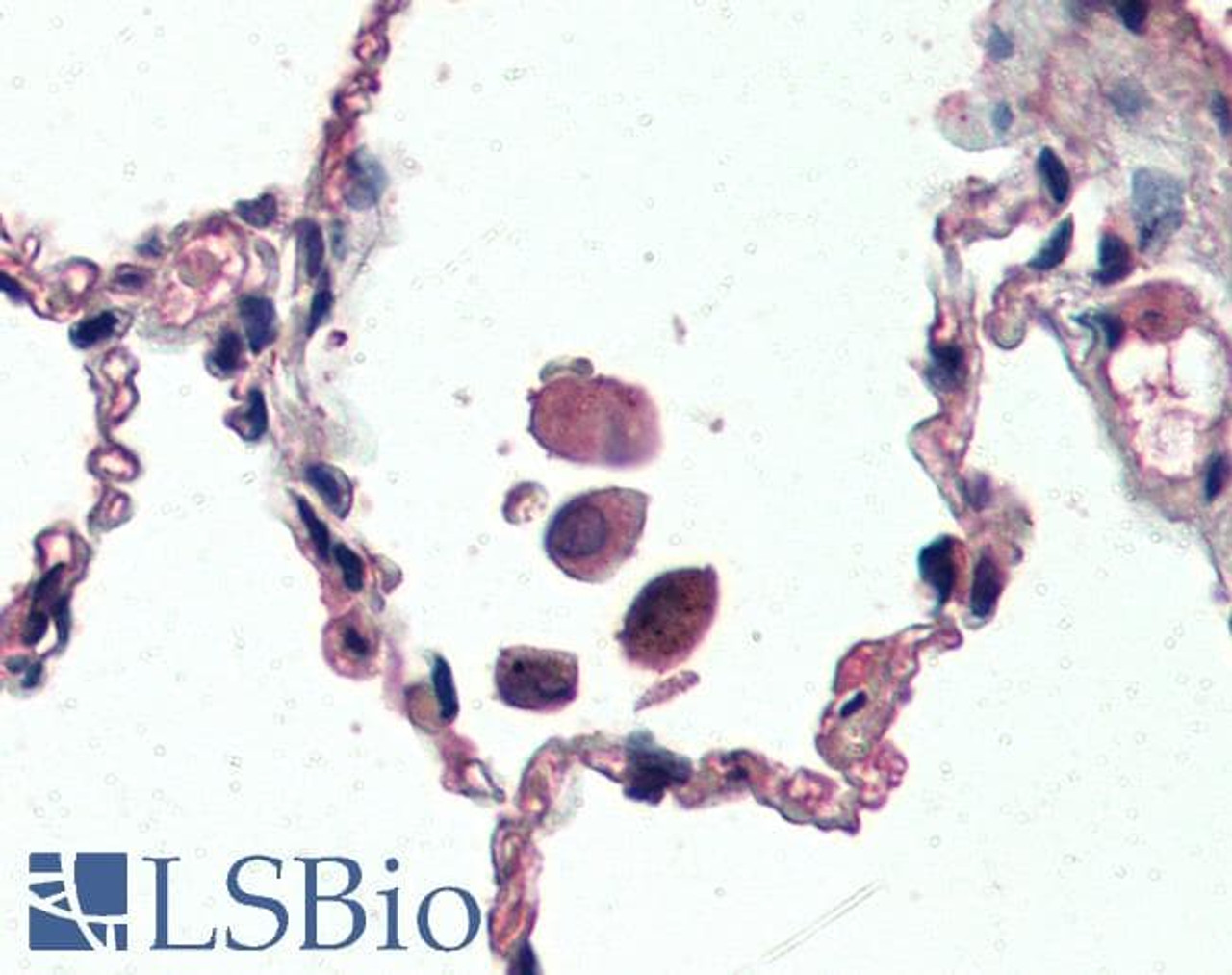 46-549 (3.75ug/ml) staining of paraffin embedded Human Skeletal Muscle. Steamed antigen retrieval with citrate buffer pH 6, AP-staining. <strong>This data is from a previous batch, not on sale.</strong>