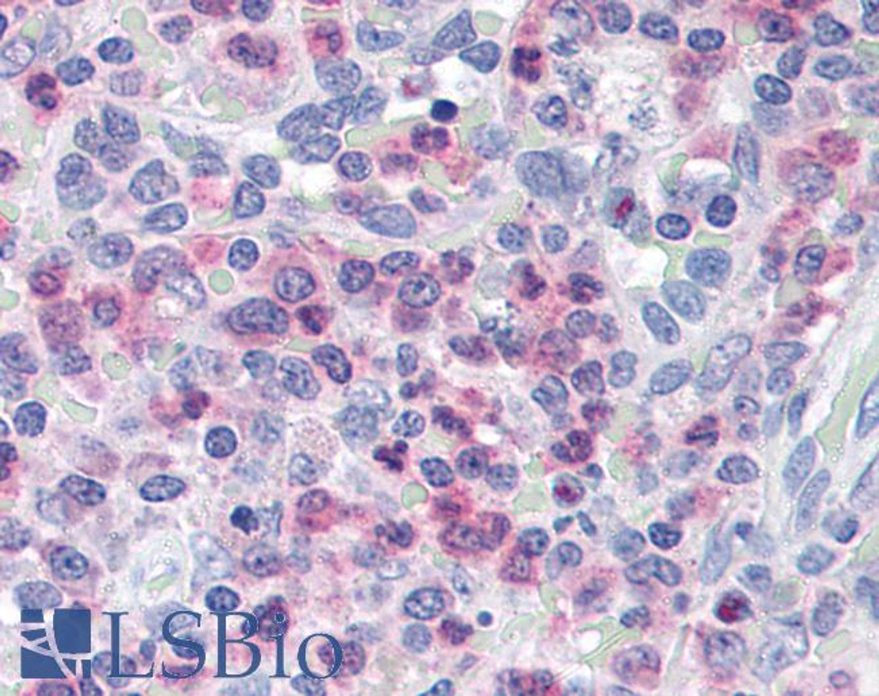 46-551 (5ug/ml) staining of paraffin embedded Human Spleen. Steamed antigen retrieval with citrate buffer pH 6, AP-staining.