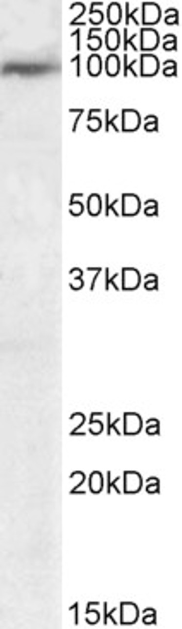 46-558 (1ug/ml) staining of Human Tonsil lysate (35ug protein in RIPA buffer) . Primary incubation was 1 hour. Detected by chemiluminescence.