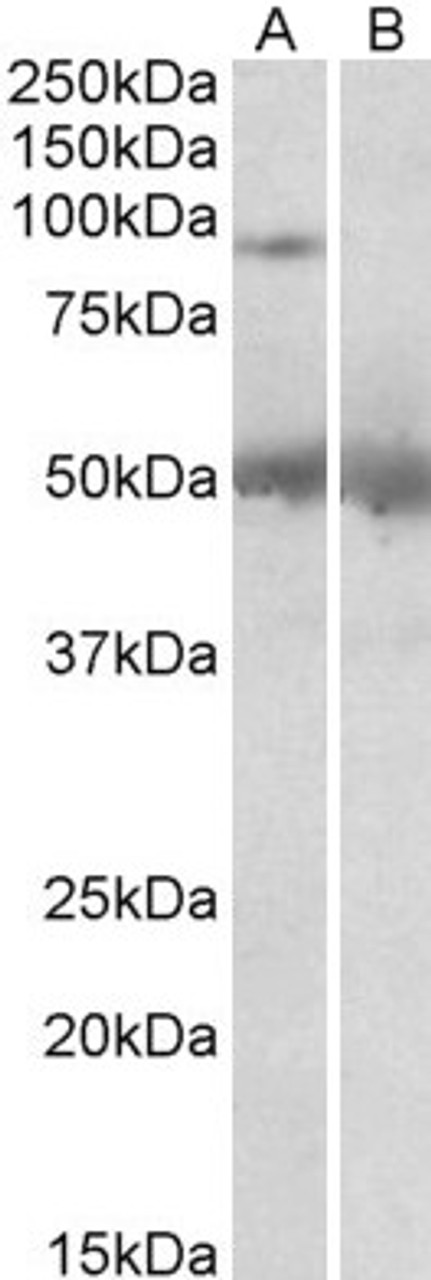 46-565 (2ug/ml) staining of Human Placenta lysate (35ug protein in RIPA buffer) with (B) and without (A) blocking with the immunizing peptide. Primary incubation was 1 hour. Detected by chemiluminescence.