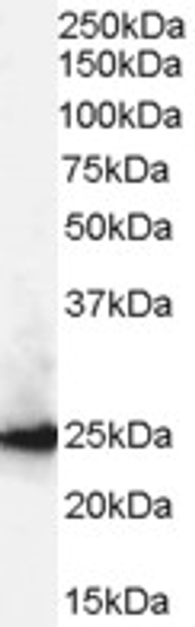 46-571 (1ug/ml) staining of Human Kidney and Liver lysates (35ug protein in RIPA buffer) . Detected by chemiluminescence.