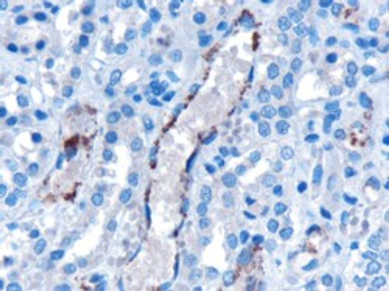 46-578 (0.5ug/ml) staining of Rat Kidney lysate (35ug protein in RIPA buffer) . Primary incubation was 1 hour. Detected by chemiluminescence.