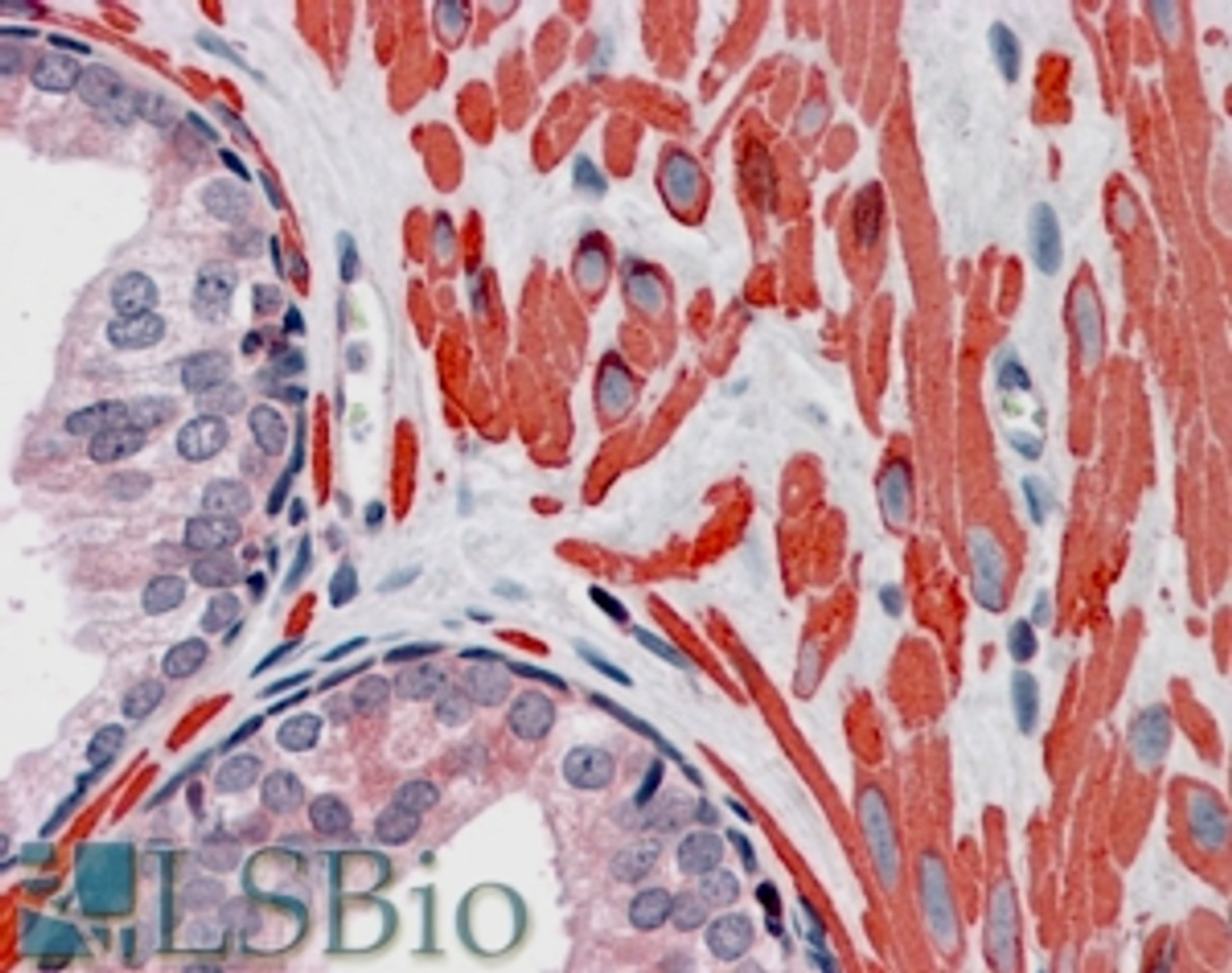 46-585 (0.03g/ml) staining of human duodenum lysate (35ug protein in RIPA buffer) . Primary incubation was 1 hour. Detected by chemiluminescence.