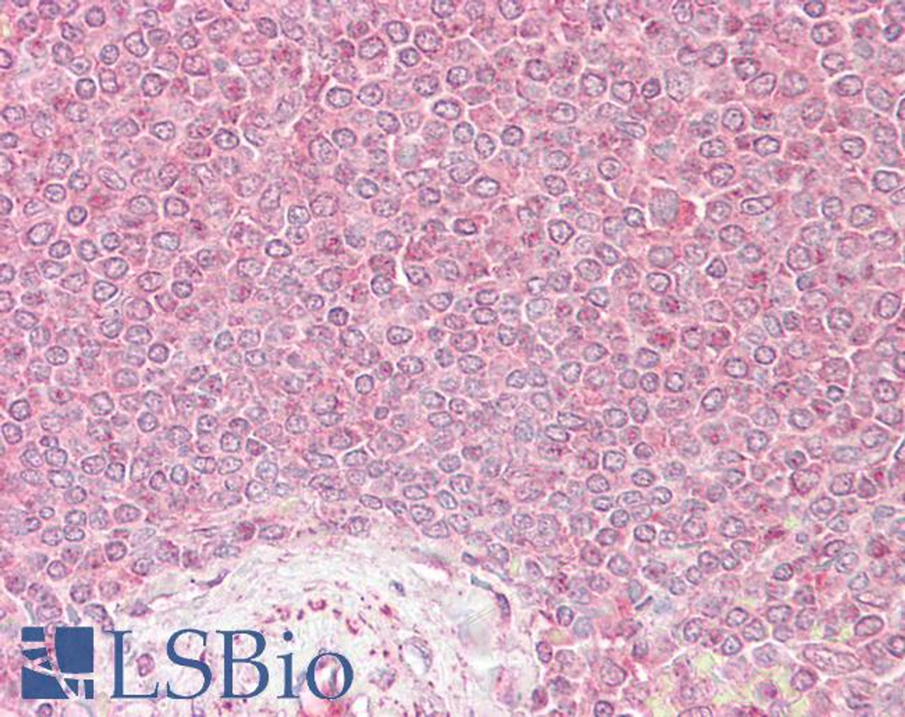 46-588 (0.03ug/ml) staining of Human Placenta lysate (35ug protein in RIPA buffer) . Primary incubation was 1 hour. Detected by chemiluminescence.