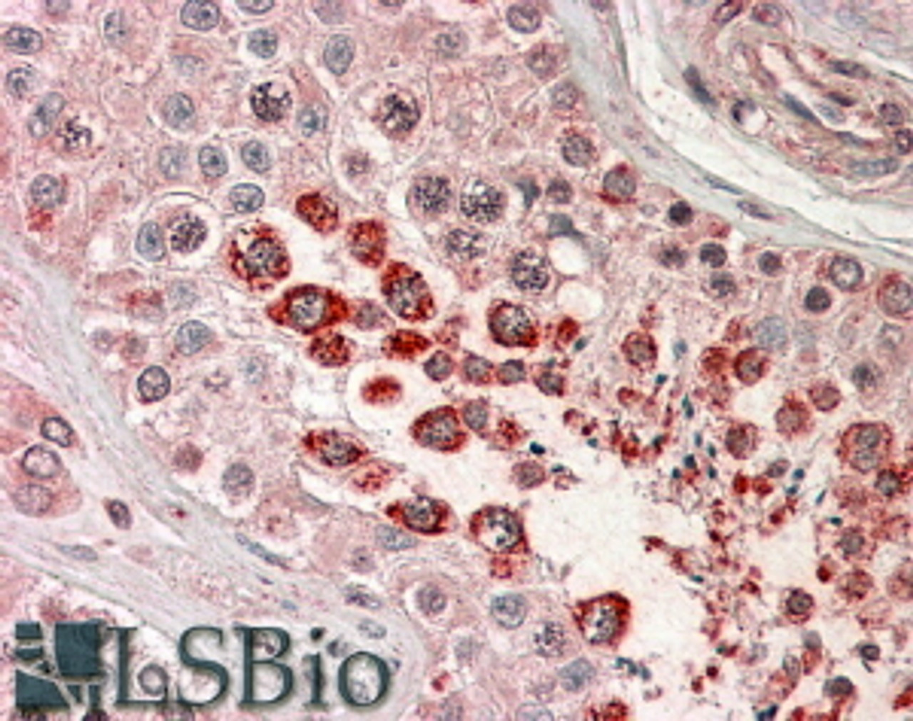 46-604 (3.8ug/ml) staining of paraffin embedded Human Testis. Steamed antigen retrieval with citrate buffer pH 6, AP-staining.