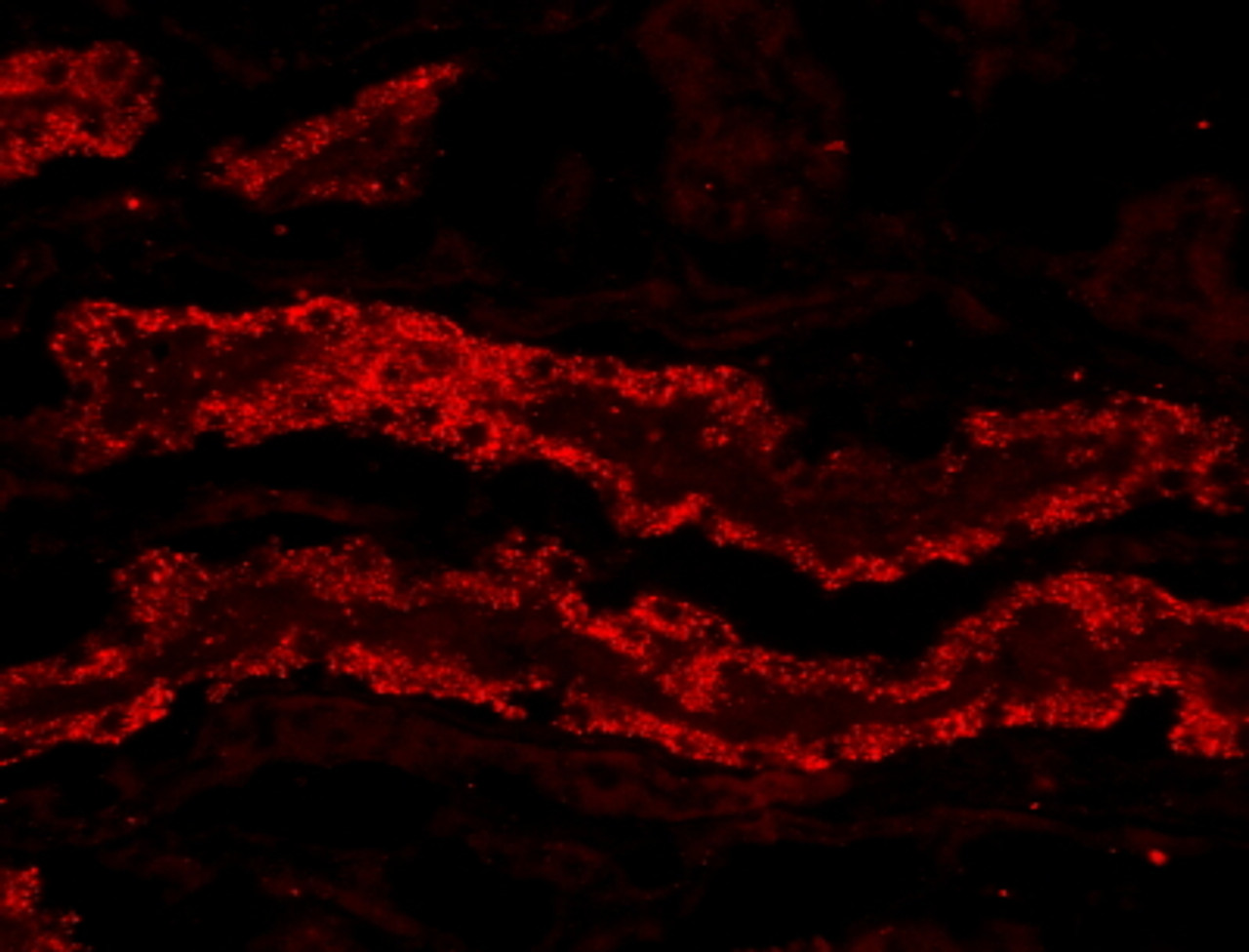 46-611 (0.1ug/ml) staining of Human Brain (Frontal Cortex) lysate (35ug protein in RIPA buffer) with (B) and without (A) blocking with the immunising peptide. Primary incubation was 1 hour. Detected by chemiluminescence.