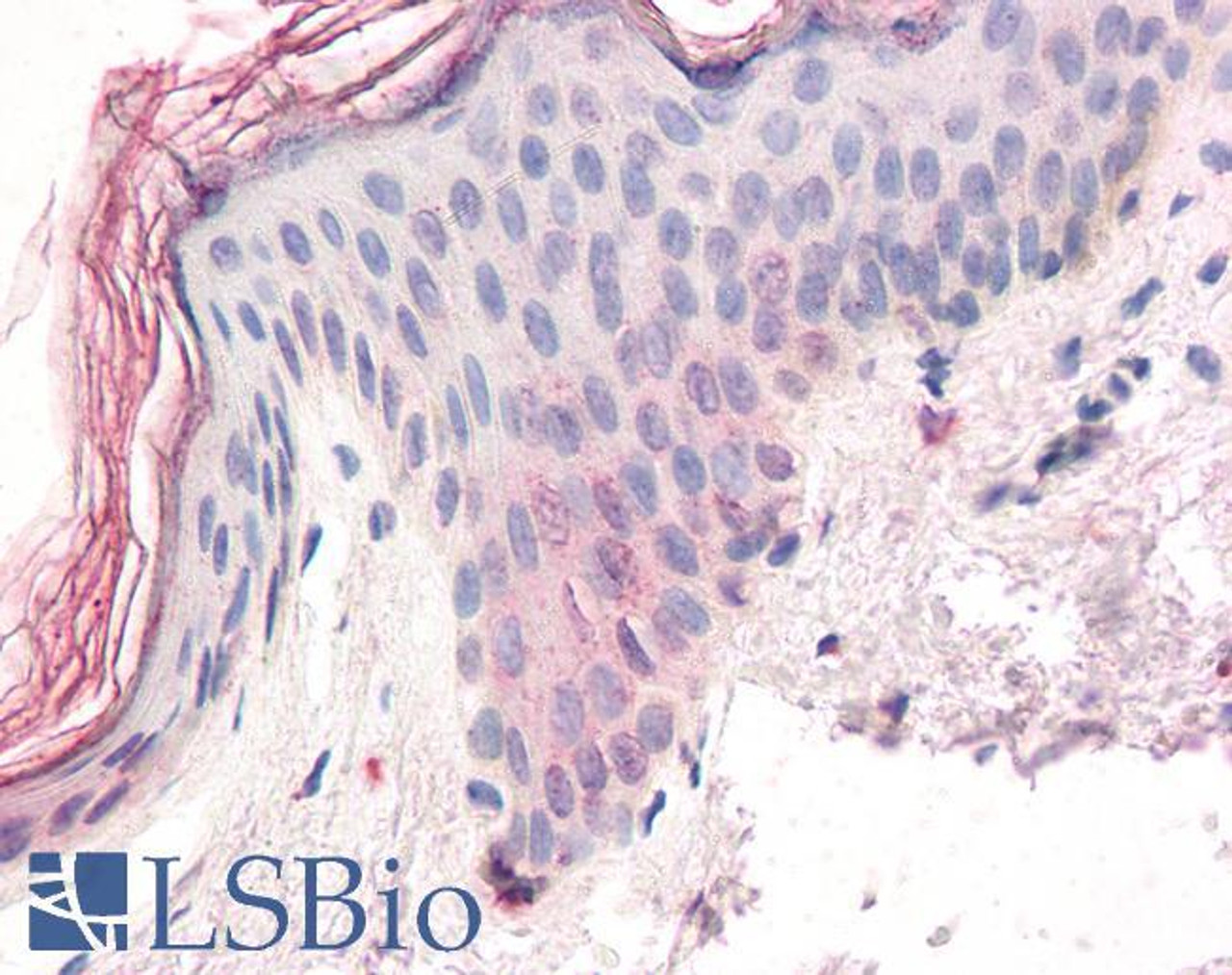 46-614 (3.75ug/ml) staining of paraffin embedded Human Skin. Steamed antigen retrieval with citrate buffer pH 6, AP-staining.