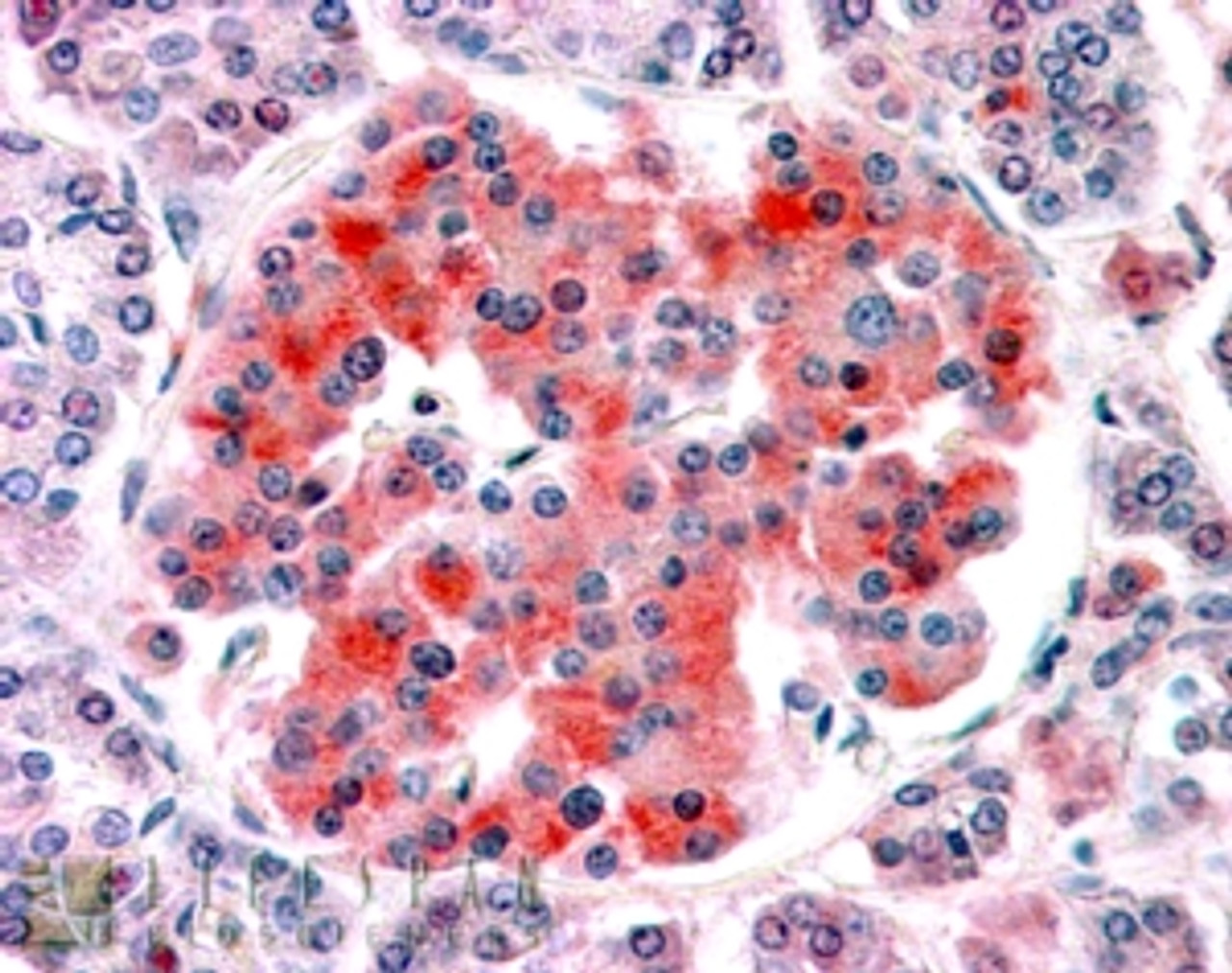 46-628 (0.5ug/ml) staining of Human Tonsil lysate (35ug protein in RIPA buffer) . Primary incubation was 1 hour. Detected by chemiluminescence.