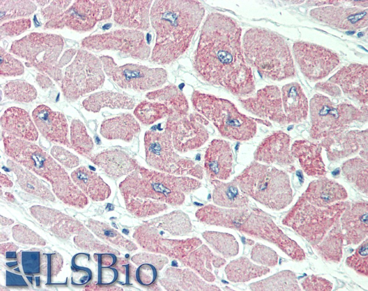 46-645 (0.1ug/ml) staining of Human Kidney lysate (35ug protein in RIPA buffer) . Primary incubation was 1 hour. Detected by chemiluminescence.