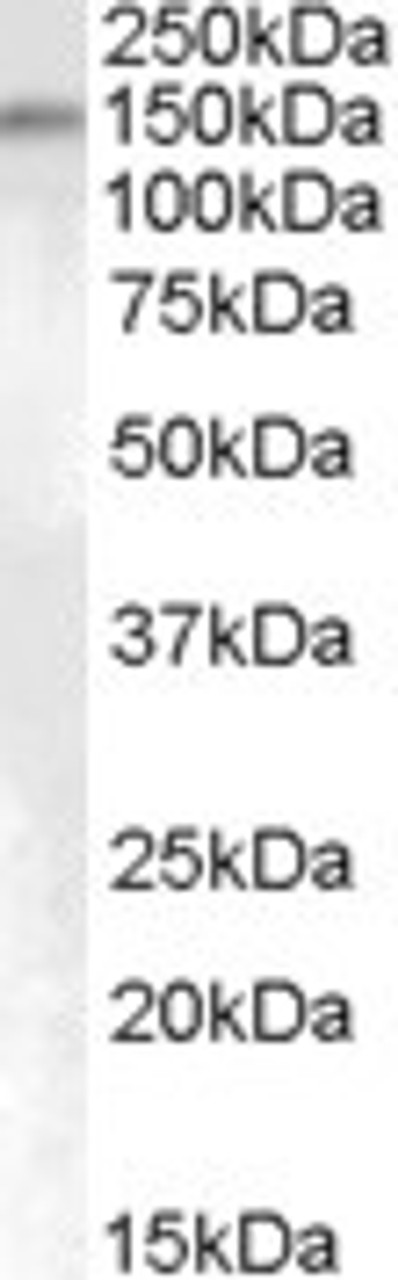 HEK293 overexpressing FAM62A and probed with 46-657 (mock transfection in first lane) .