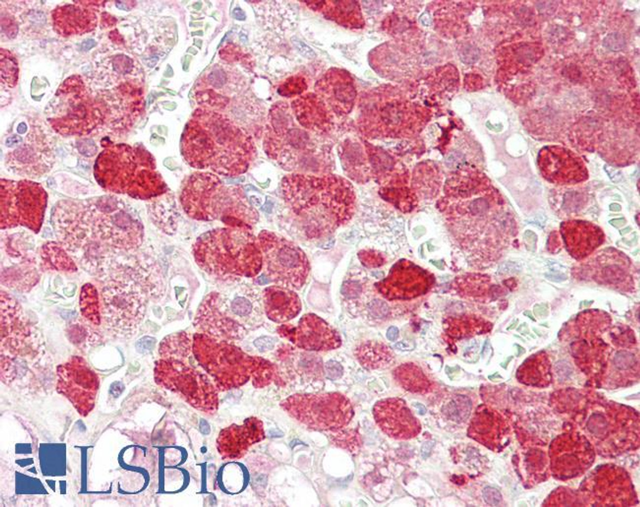 46-668 (0.3ug/ml) staining of Human Liver cell lysate (35ug protein in RIPA buffer) . Primary incubation was 1 hour. Detected by chemiluminescence.