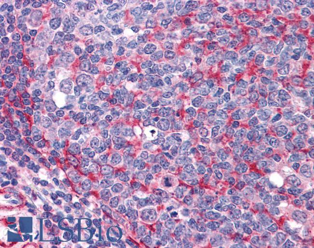 46-669 (0.3ug/ml) staining of Human Brain (Frontal Cortex) lysate (35ug protein in RIPA buffer) . Primary incubation was 1 hour. Detected by chemiluminescence.