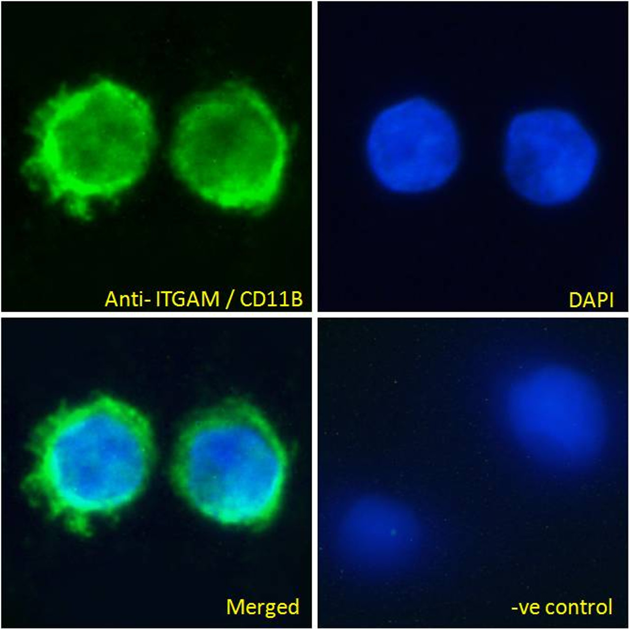 46-692 Flow cytometric analysis of paraformaldehyde fixed Kelly cells (blue line) , permeabilized with 0.5% Triton. Primary incubation 1hr (10ug/ml) followed by Alexa Fluor 488 secondary antibody (1ug/ml) . IgG control: Unimmunized goat IgG (black line) fo