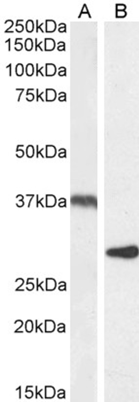 46-693 (2ug/ml) staining of Human Pancrease lysate (35ug protein in RIPA buffer) . Detected by chemiluminescence.