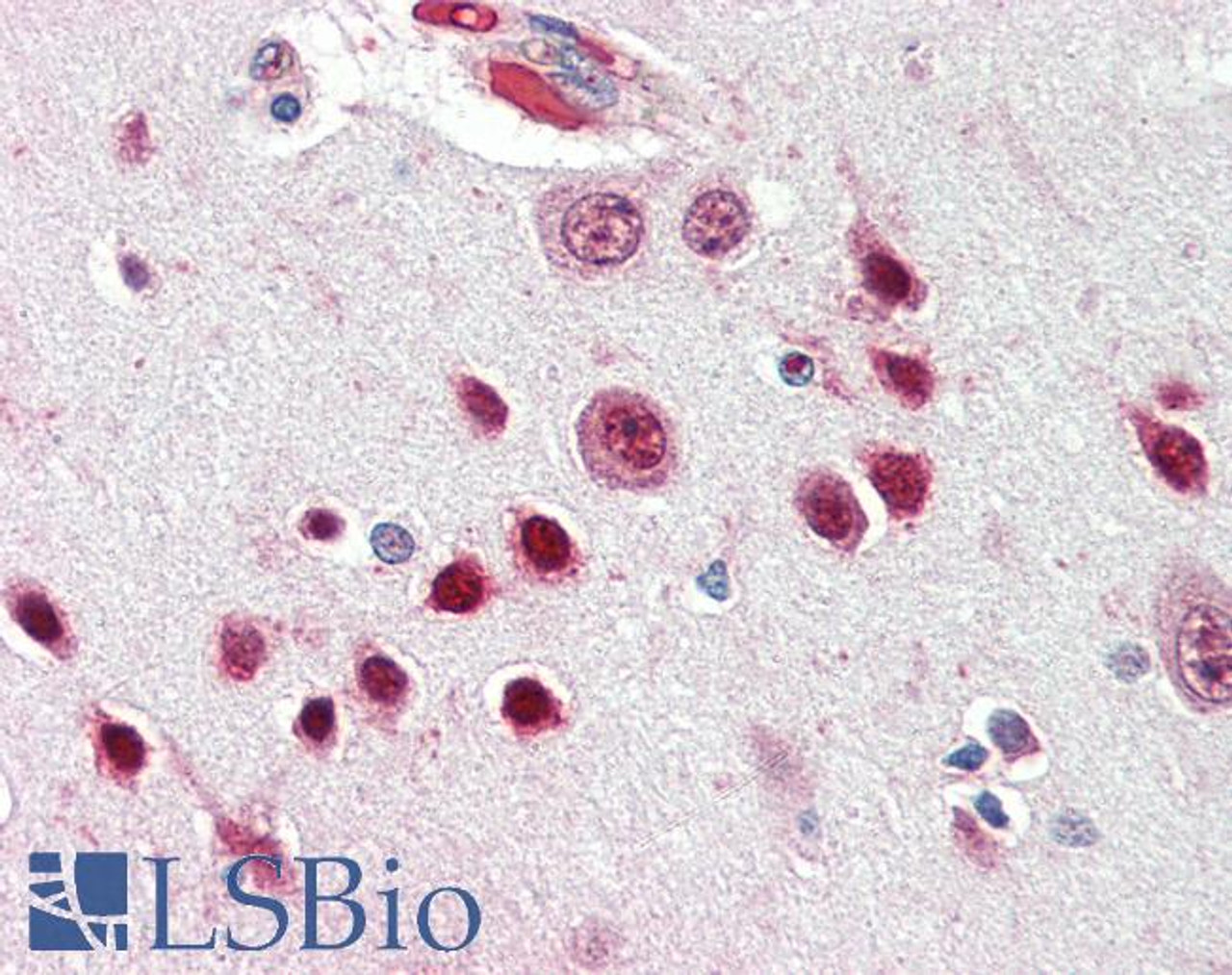 46-694 (0.01ug/ml) staining of Human Breast Cancer lysate (35ug protein in RIPA buffer) . Detected by chemiluminescence.