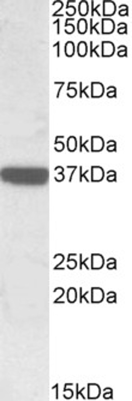 46-726 (2ug/ml) staining of Human Peripheral Blood Mononucleocyte lysate (35ug protein in RIPA buffer) . Primary incubation was 1 hour. Detected by chemiluminescence.